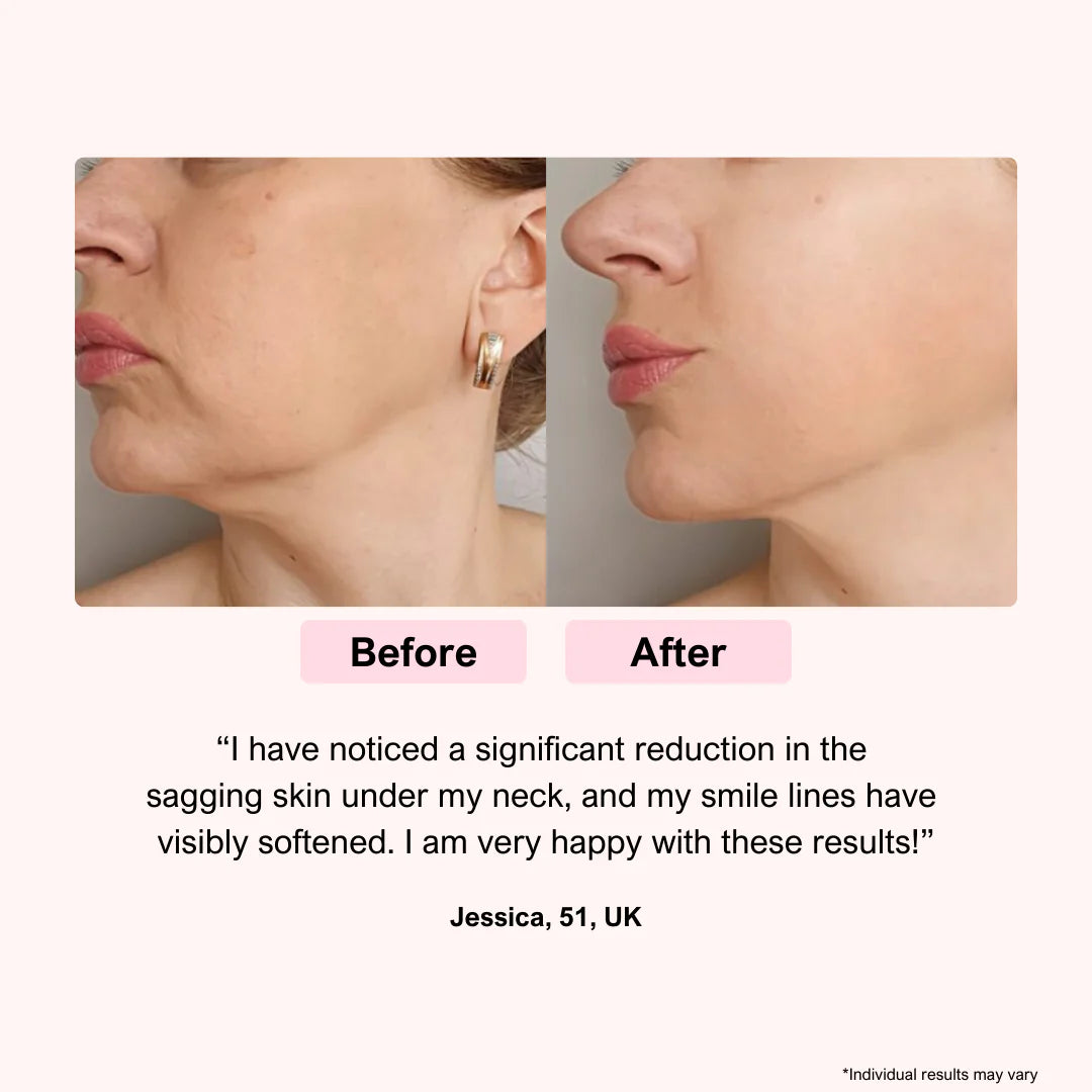 LUNA&SKIN RegenMask™ Skin Rejuvenating LED face & neck mask