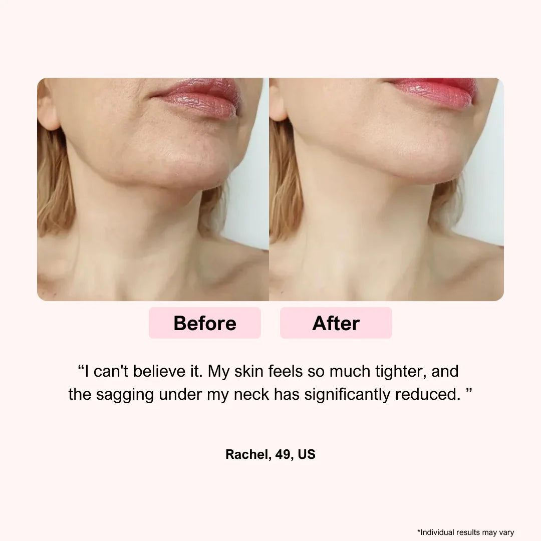 LUNA&SKIN RegenMask™ Skin Rejuvenating LED face & neck mask